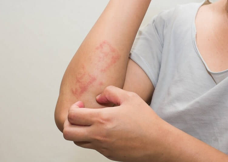 Không vệ sinh nệm sẽ biến chúng thành ổ chứa cho ký sinh trùng.