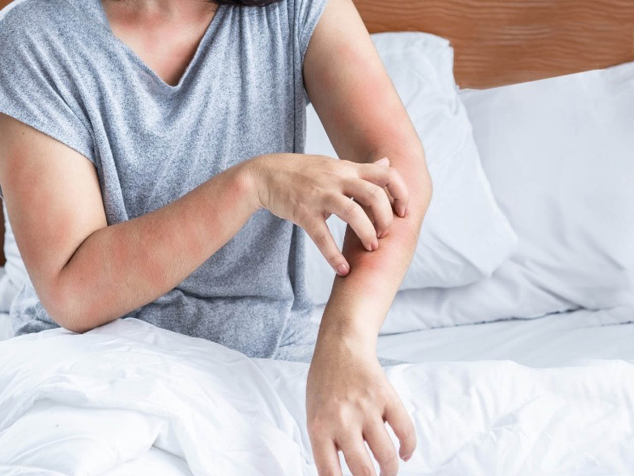 Sử dụng gối củ gây ngứa ngoáy, khó chịu.